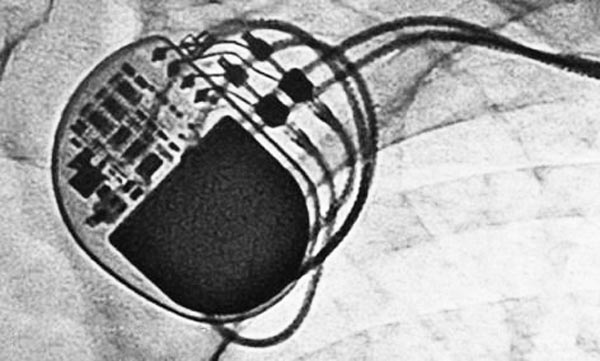 激光焊接在醫(yī)療行業(yè)技術中的應用